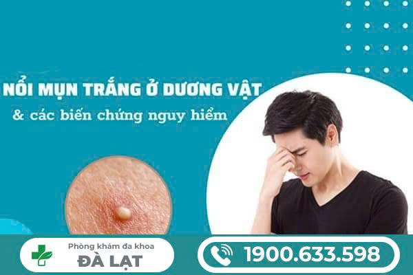 Hình ảnh minh họa